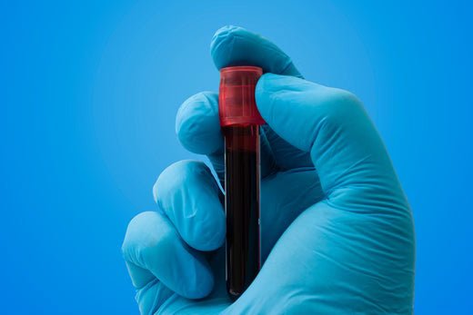 What Are A1C Levels And What Do They Mean? - Nixulin™ Blood Sugar Support